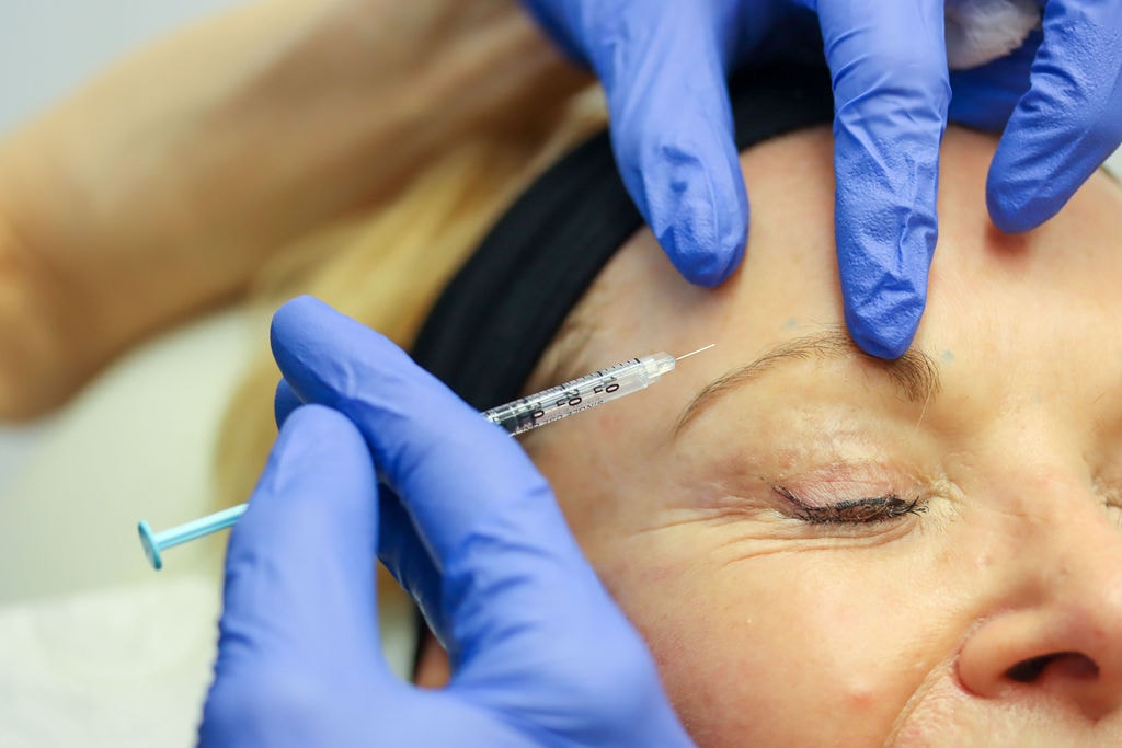 Anti-Wrinkle Injections