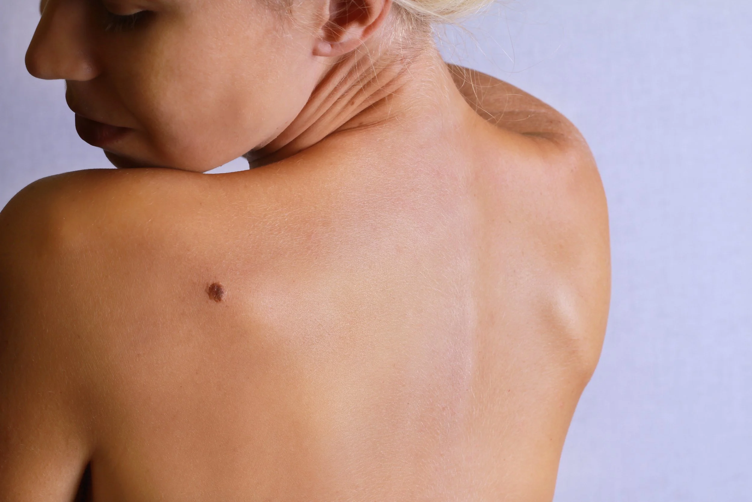 Skin cancer examination for a suspicious lesion