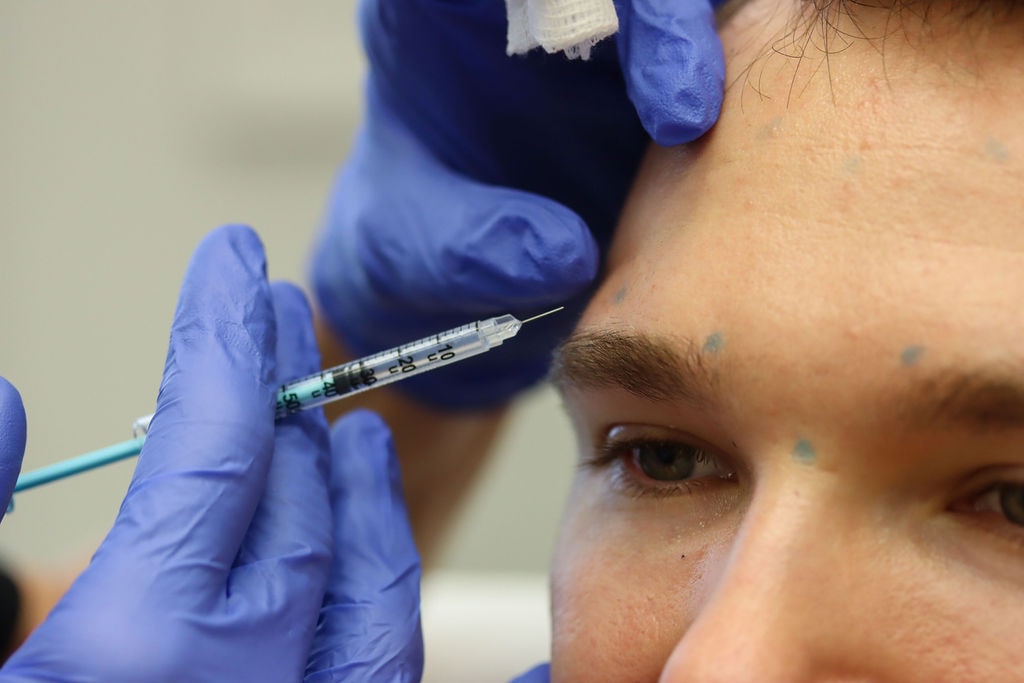 Anti-wrinkle injection treatment for frown lines